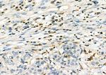 PTGR2 Antibody in Immunohistochemistry (Paraffin) (IHC (P))