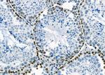 PTGR2 Antibody in Immunohistochemistry (Paraffin) (IHC (P))