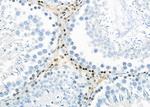 PTGR2 Antibody in Immunohistochemistry (Paraffin) (IHC (P))