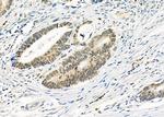 RALY Antibody in Immunohistochemistry (Paraffin) (IHC (P))