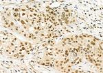 RALY Antibody in Immunohistochemistry (Paraffin) (IHC (P))