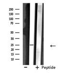 NDFIP1 Antibody in Western Blot (WB)