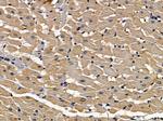 IL15RA Antibody in Immunohistochemistry (Paraffin) (IHC (P))