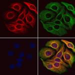 PLCB2 Antibody in Immunocytochemistry (ICC/IF)