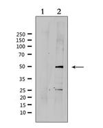 SUV39H2 Antibody in Western Blot (WB)