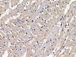 PHKG1 Antibody in Immunohistochemistry (Paraffin) (IHC (P))