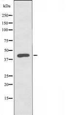 PHKG1 Antibody in Western Blot (WB)