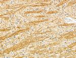 MCPH1 Antibody in Immunohistochemistry (Paraffin) (IHC (P))