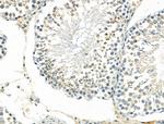 MCPH1 Antibody in Immunohistochemistry (Paraffin) (IHC (P))