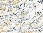 RUNX3 Antibody in Immunohistochemistry (Paraffin) (IHC (P))