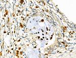 RUNX3 Antibody in Immunohistochemistry (Paraffin) (IHC (P))