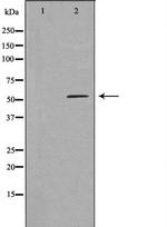 LBP Antibody in Western Blot (WB)