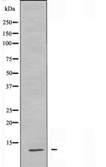 H4K5ac Antibody in Western Blot (WB)