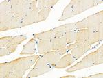 ADORA3 Antibody in Immunohistochemistry (Paraffin) (IHC (P))