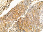 NPY2R Antibody in Immunohistochemistry (Paraffin) (IHC (P))