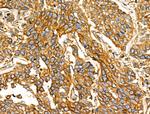 NPY2R Antibody in Immunohistochemistry (Paraffin) (IHC (P))