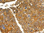 NPY2R Antibody in Immunohistochemistry (Paraffin) (IHC (P))