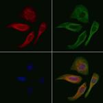 Rhodopsin Antibody in Immunocytochemistry (ICC/IF)