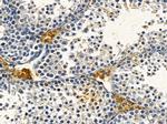 OR2B8P Antibody in Immunohistochemistry (Paraffin) (IHC (P))