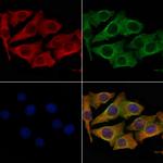 OR4A4/OR4A47 Antibody in Immunocytochemistry (ICC/IF)