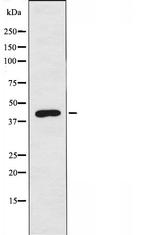 SLC52A2 Antibody in Western Blot (WB)