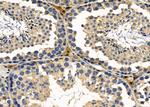 GPR10 Antibody in Immunohistochemistry (Paraffin) (IHC (P))