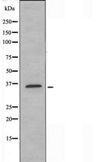 TAS2R7 Antibody in Western Blot (WB)