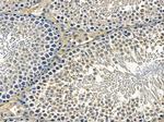 OR5A1 Antibody in Immunohistochemistry (Paraffin) (IHC (P))