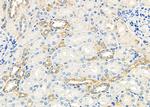 Perforin Antibody in Immunohistochemistry (Paraffin) (IHC (P))