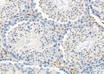 Perforin Antibody in Immunohistochemistry (Paraffin) (IHC (P))