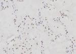 CHOP Antibody in Immunohistochemistry (Paraffin) (IHC (P))