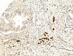 CHOP Antibody in Immunohistochemistry (Paraffin) (IHC (P))