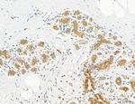 CHOP Antibody in Immunohistochemistry (Paraffin) (IHC (P))