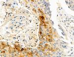 CHOP Antibody in Immunohistochemistry (Paraffin) (IHC (P))