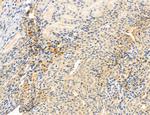 CHOP Antibody in Immunohistochemistry (Paraffin) (IHC (P))