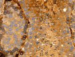 CHOP Antibody in Immunohistochemistry (Paraffin) (IHC (P))