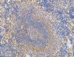 CHOP Antibody in Immunohistochemistry (Paraffin) (IHC (P))