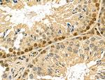 NUDT6 Antibody in Immunohistochemistry (Paraffin) (IHC (P))