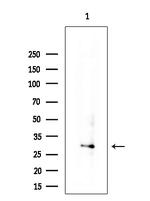 NUDT6 Antibody in Western Blot (WB)