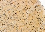 OLFM1 Antibody in Immunohistochemistry (Paraffin) (IHC (P))