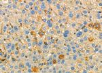 TCL1A Antibody in Immunohistochemistry (Paraffin) (IHC (P))