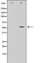 ACVR1C Antibody in Western Blot (WB)