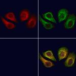 NEK8 Antibody in Immunocytochemistry (ICC/IF)