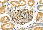 SLC27A2 Antibody in Immunohistochemistry (Paraffin) (IHC (P))