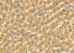 SLC27A2 Antibody in Immunohistochemistry (Paraffin) (IHC (P))