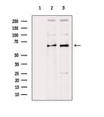 SLC27A2 Antibody in Western Blot (WB)