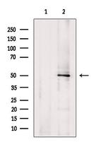 TYMP Antibody in Western Blot (WB)