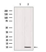 SPINK1 Antibody in Western Blot (WB)