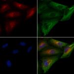 SERCA2 ATPase Antibody in Immunocytochemistry (ICC/IF)