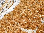 CYR61 Antibody in Immunohistochemistry (Paraffin) (IHC (P))